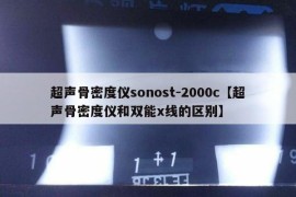 超声骨密度仪sonost-2000c【超声骨密度仪和双能x线的区别】