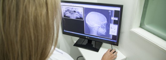 依科视朗X射线机：医学诊断的新视界